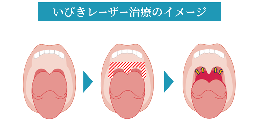 あかいけ耳鼻いんこう科